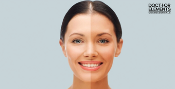 Difference B/W Skin Lightening & Skin Brightening