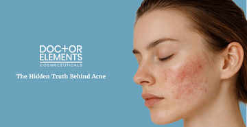 The Hidden Truth Behind Acne