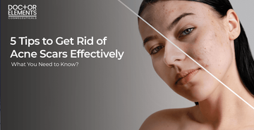 5 tips to effectively get rid of acne scars